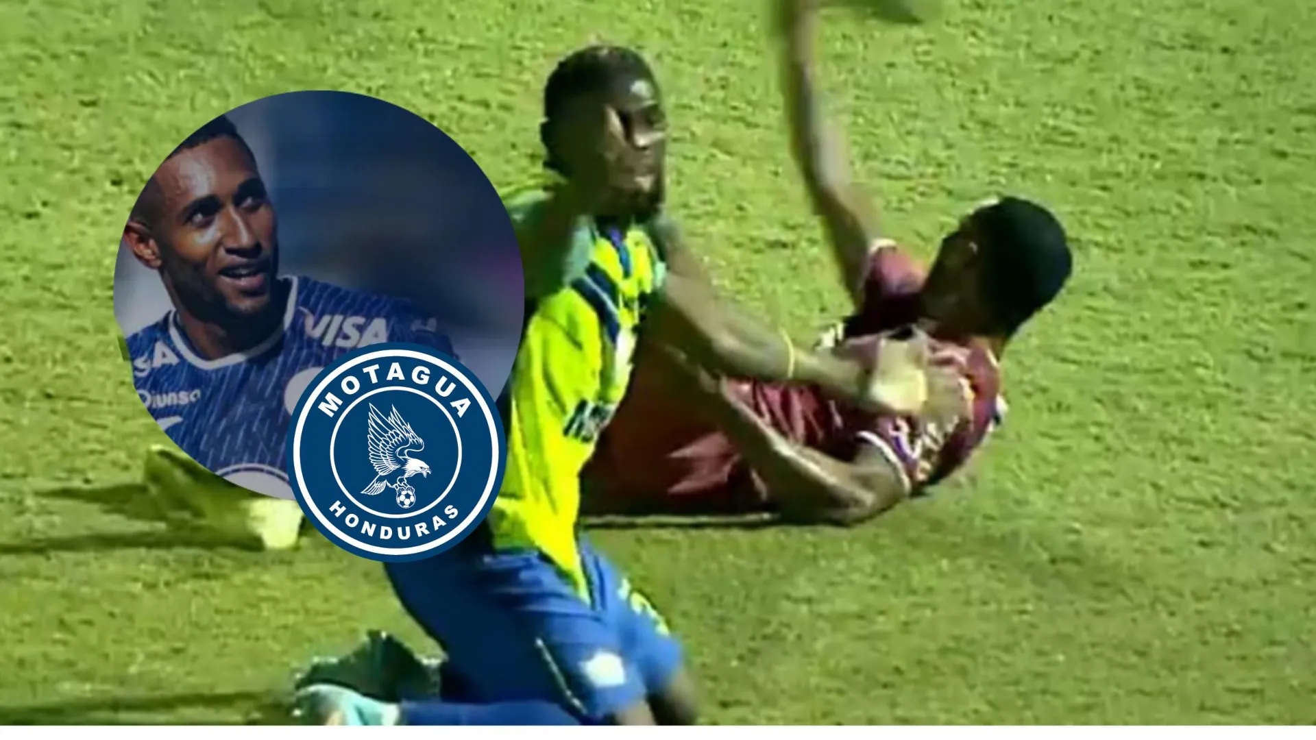 Motagua adelanta lo qué pasará con la carrera de Romario Da Silva tras sufrir terrible lesión