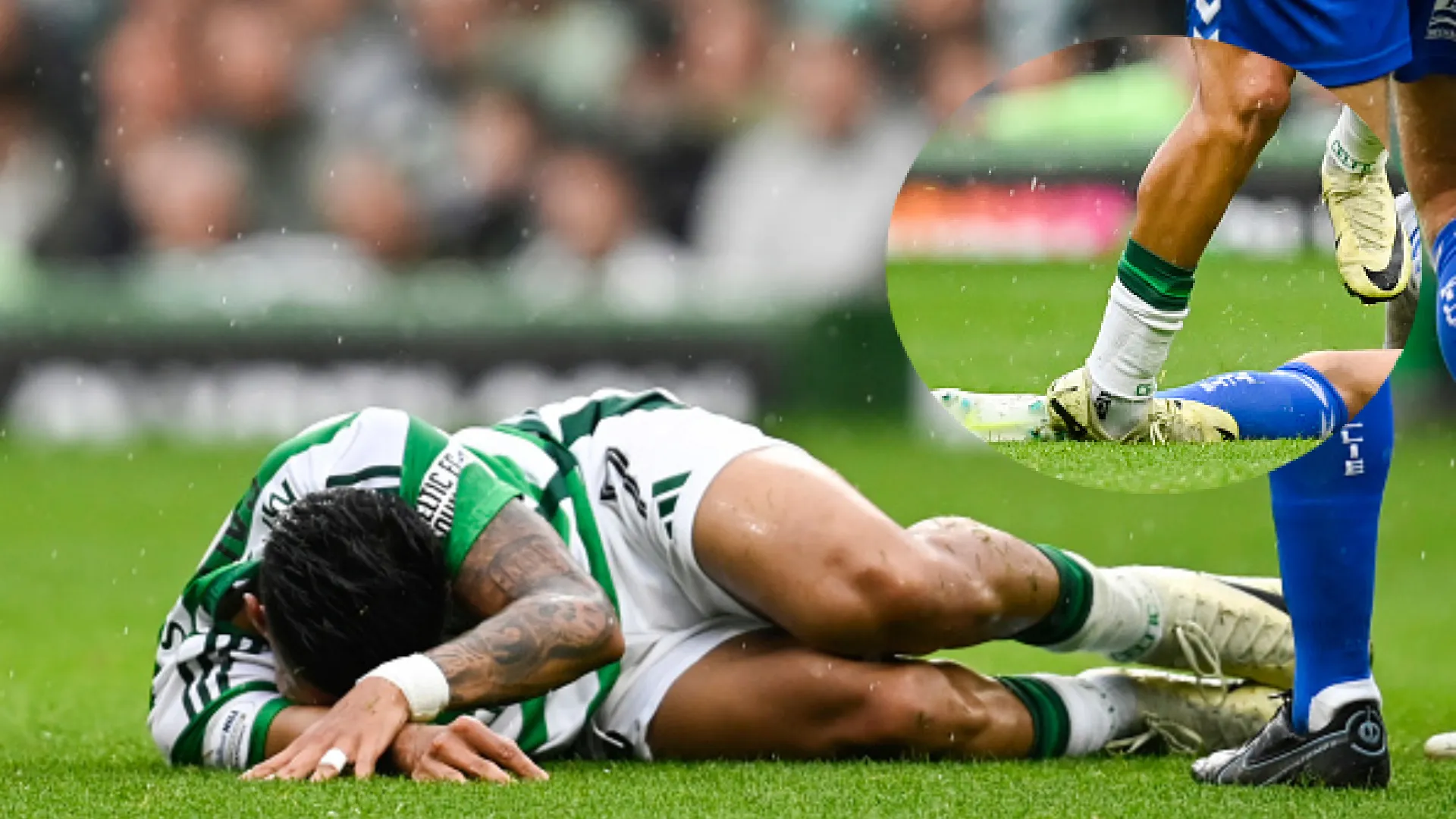¡Brutal! La escalofriante entrada sobre Luis Palma que alarma a Celtic y a Honduras (Video)