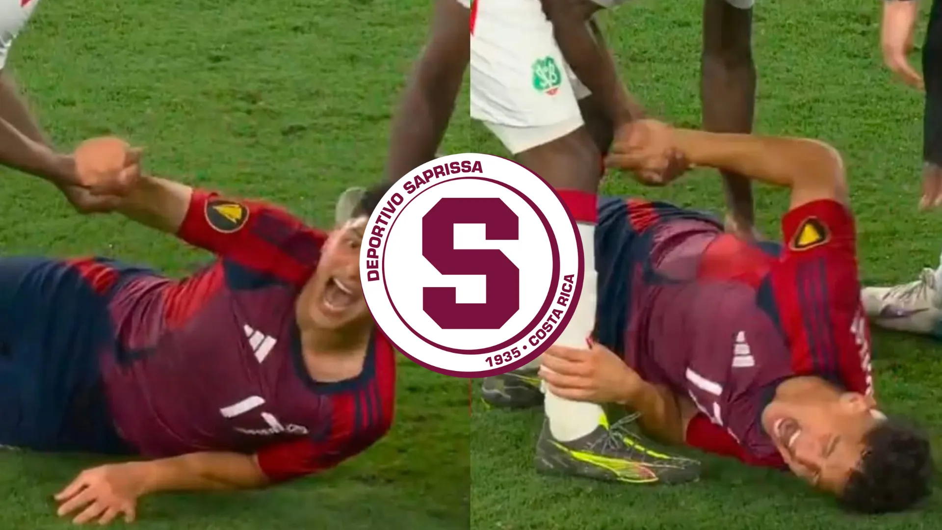 saprissa-lesion warren madrigal-costa rica