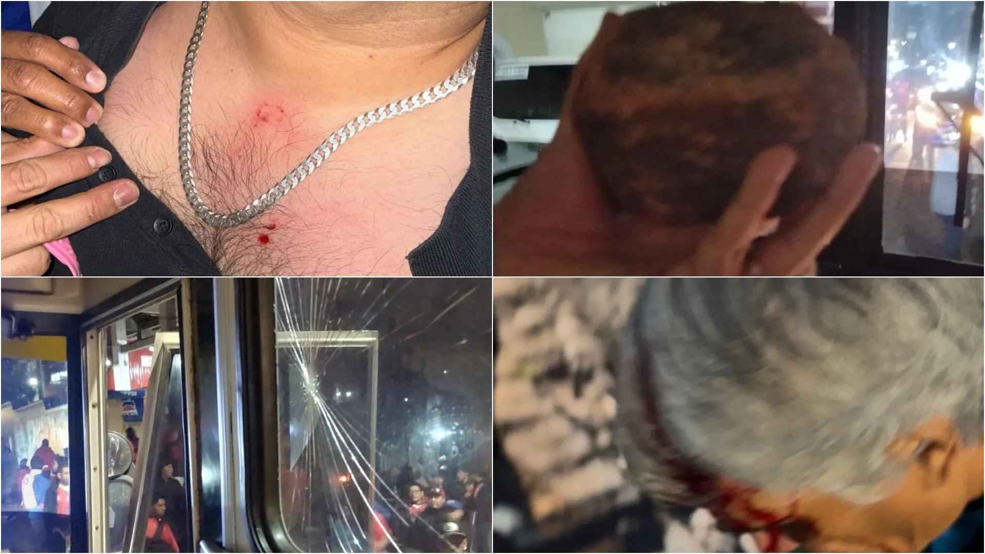 Lamentable: Aficionados de Xelajú agreden a jugadores de Guastatoya en la Liga Nacional de Guatemala