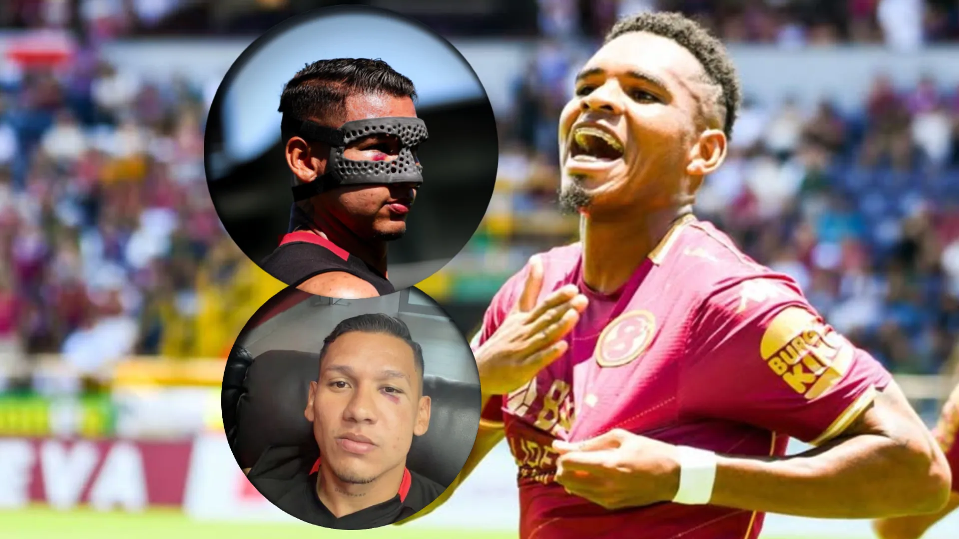 “8 partidos de sanción”: Orlando Sinclair recibe el pedido de sentencia que todo Alajuelense reclamó por lesionar a Fernando Piñar