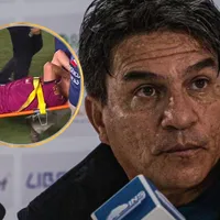 Vladimir Quesada confirma el peor escenario: los detalles de la lesión de Óscar Duarte que estremecen a Saprissa
