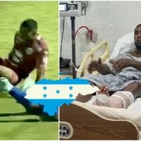 Romario Da Silva se suma a la lista: las lesiones más impactantes que han estremecido a Honduras