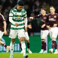 Celtic de Luis Palma sumó otra derrota y comienza a perder la ventaja