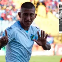 Comunicaciones expide parte médico de Stheven Robles: qué tiene y cuándo volverá a jugar