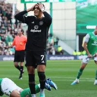 Mala jornada para Celtic y Luis Palma en el regreso a la Premiership de Escocia