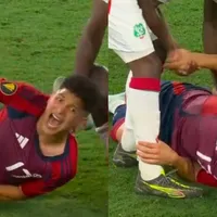 dura lesion de warren madrigal ante surinam