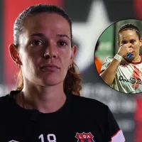 "Absoluta tranquilidad": Emelie Valenciano rompe el silencio tras lesionar a Carolina Venegas con un mensaje directo para Saprissa