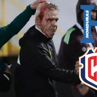 Concacaf hace advertencia a Honduras: el horripilante motivo por el que puede ser castigado ante Costa Rica