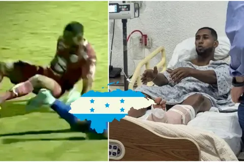 Romario Da Silva se suma a la lista: las lesiones más impactantes que han estremecido a Honduras