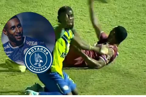 Motagua adelanta lo qué pasará con la carrera de Romario Da Silva tras sufrir terrible lesión