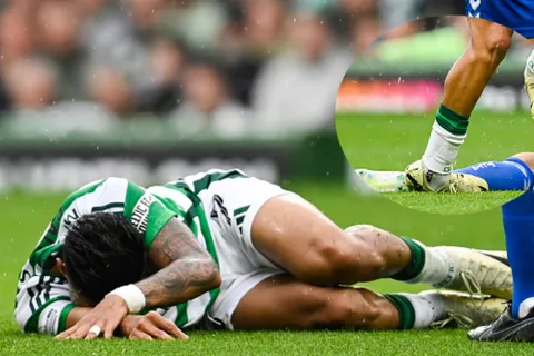 ¡Brutal! La escalofriante entrada sobre Luis Palma que alarma a Celtic y a Honduras (Video)
