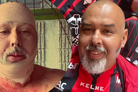 “Me querían matar”: aficionado de Alajuelense detalla la barbarie sufrida en Comunicaciones