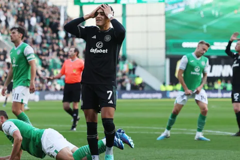 Mala jornada para Celtic y Luis Palma en el regreso a la Premiership de Escocia