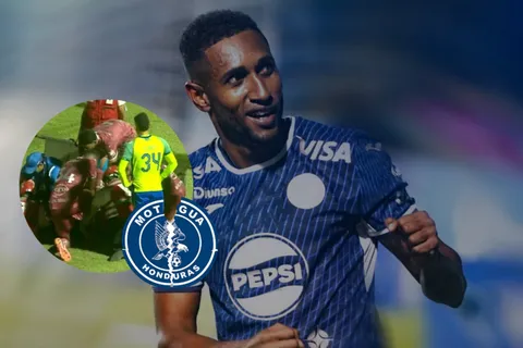 Todo Motagua consternado por la última noticia de la lesión de Romario Da Silva y el tiempo que estaría de baja