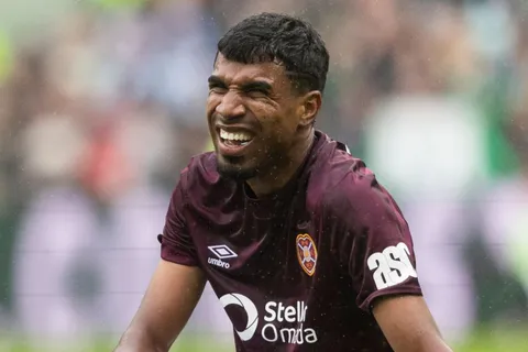 En muletas: lesión de Gerald Taylor despierta preocupación en Escocia y Costa Rica