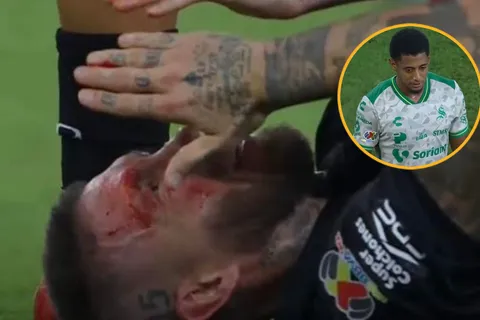 La alarmante estadística de Choco Lozano que asusta a Honduras tras la brutal patada a Sergio Ramos que le partió la cara
