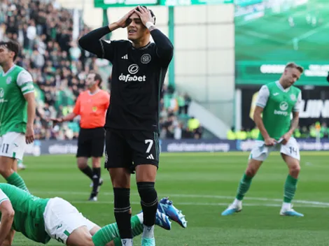 Mala jornada para Celtic y Luis Palma en el regreso a la Premiership de Escocia