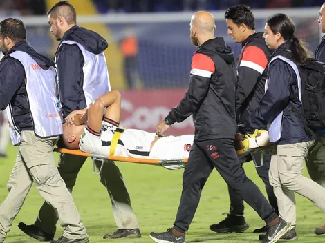 Jugador de Alajuelense sufre lesión grave y se pierde lo que resta del torneo
