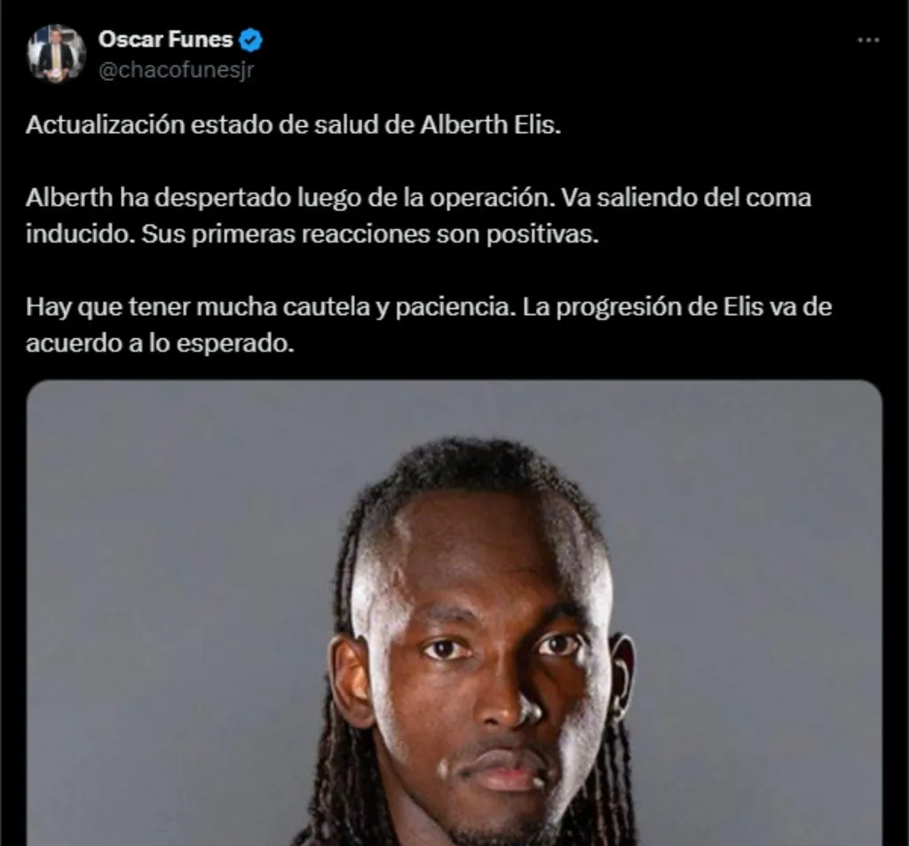 Alberth Elis va saliendo del coma inducido. (Foto: X)