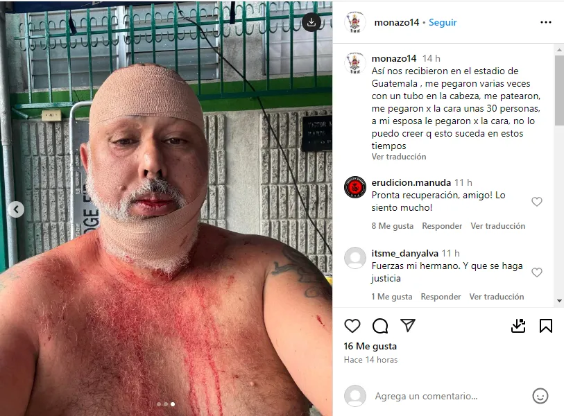 El propio Mono Castro contó lo sucedido en su cuenta de Instagram.