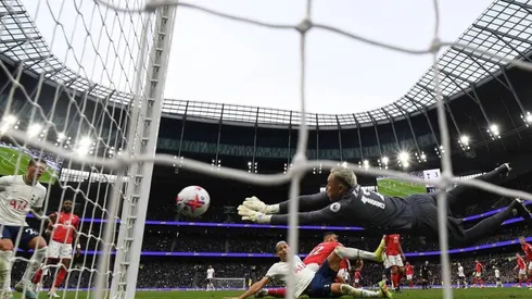 Preocupación para Keylor Navas en el Nottingham Forest