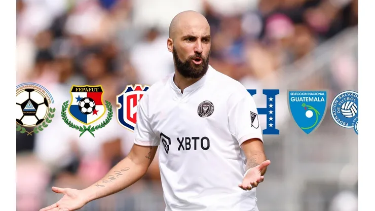 Gonzalo Higuaín no tiene idea sobre el fútbol de Centroamérica