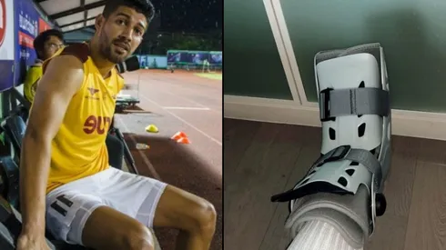 La lesión de Nelson Bonilla es más grave de lo que se esperaba