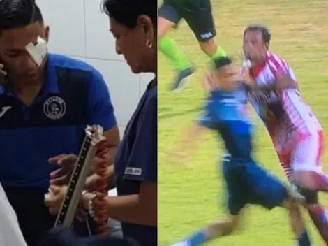 Emilio Izaguirre, de herido a expulsado en solo una semana con el Motagua