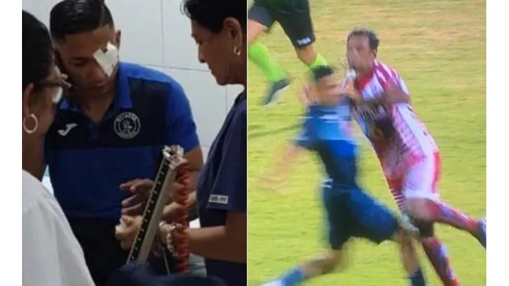 Emilio Izaguirre
