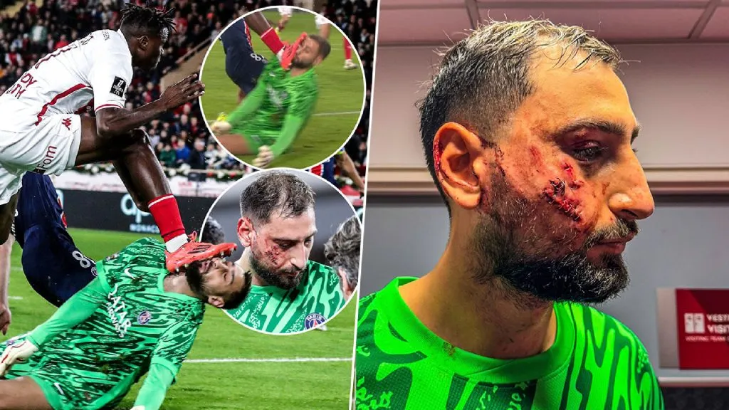 Así quedó el restro de Donnarumma.