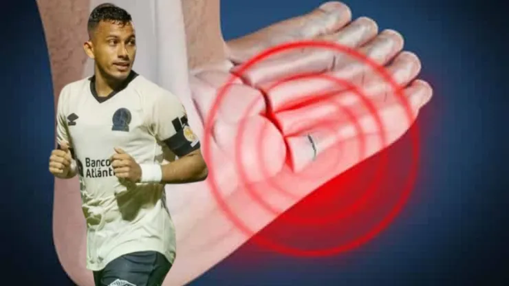 Edwin Rodríguez se perdió toda la primera vuelta del torneo Clausura 2024.