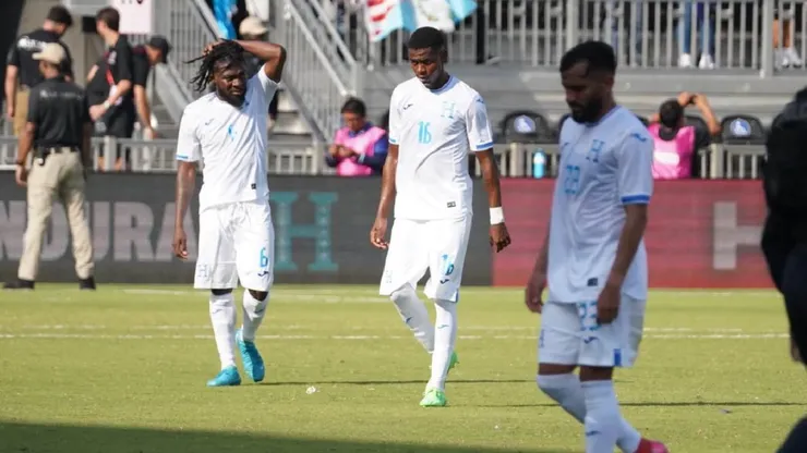 Reinaldo Rueda no se contuvo y estalló contra los futbolistas que juegan en la Liga Nacional.