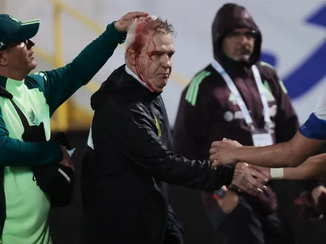 La horripilante razón por la que Honduras jugará a puertas cerradas contra Bermudas