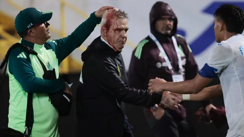 Honduras no contará con aficionados en su próximo partido de local.