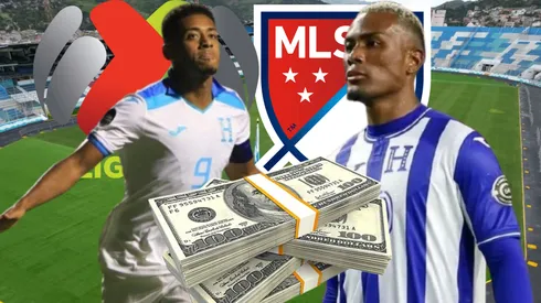 Existe una clara diferencia de salario que existe entre Deiby Flores y Choco Lozano.