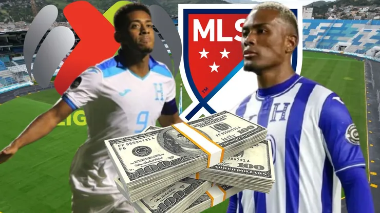 Existe una clara diferencia de salario que existe entre Deiby Flores y Choco Lozano.