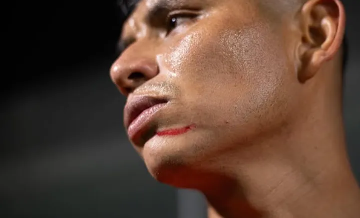 Así quedó la pera de Sansores.