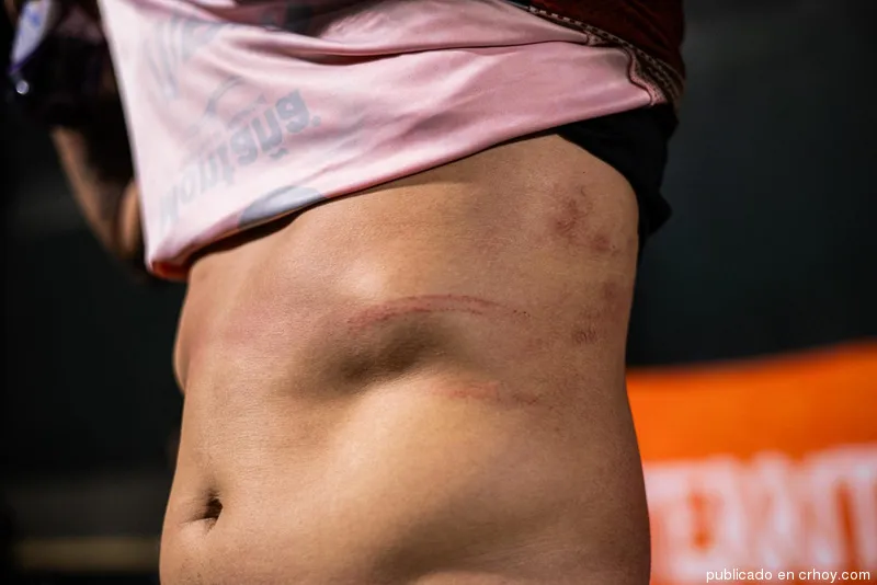 Los rasguños que recibió Sansores.