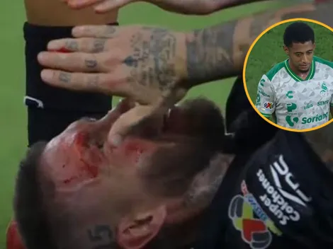 La brutal patada de Choco Lozano que le partió la cara a Sergio Ramos