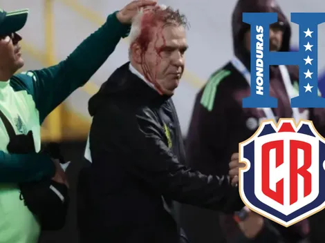 Concacaf hace advertencia a Honduras: el horripilante motivo por el que puede ser castigado