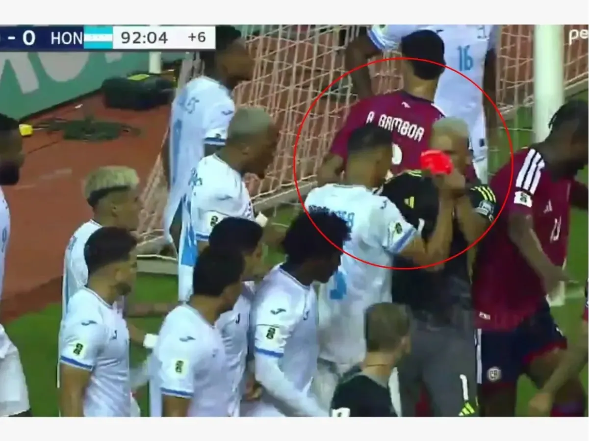 Esta fue una de las imágenes que dejó el encontronazo de Kervin Arriaga y Keylor Navas.