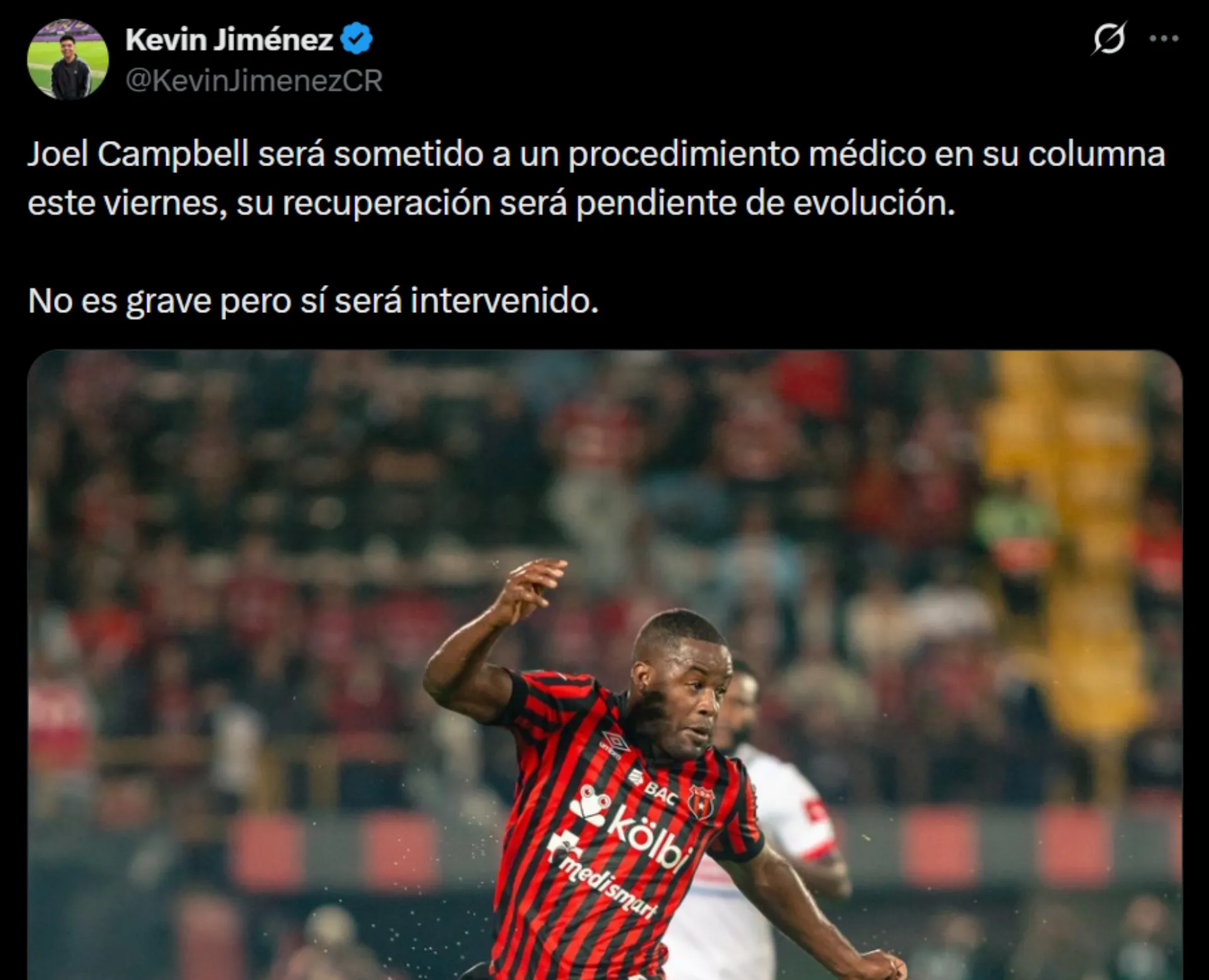 Joel Campbell será intervenido en su columna.