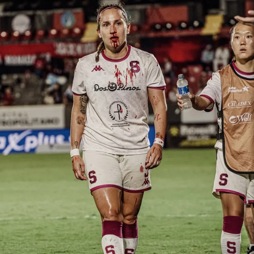 Así dejó la cancha Carolina Venegas en el clásico contra Alajuelense. (Saprissa)