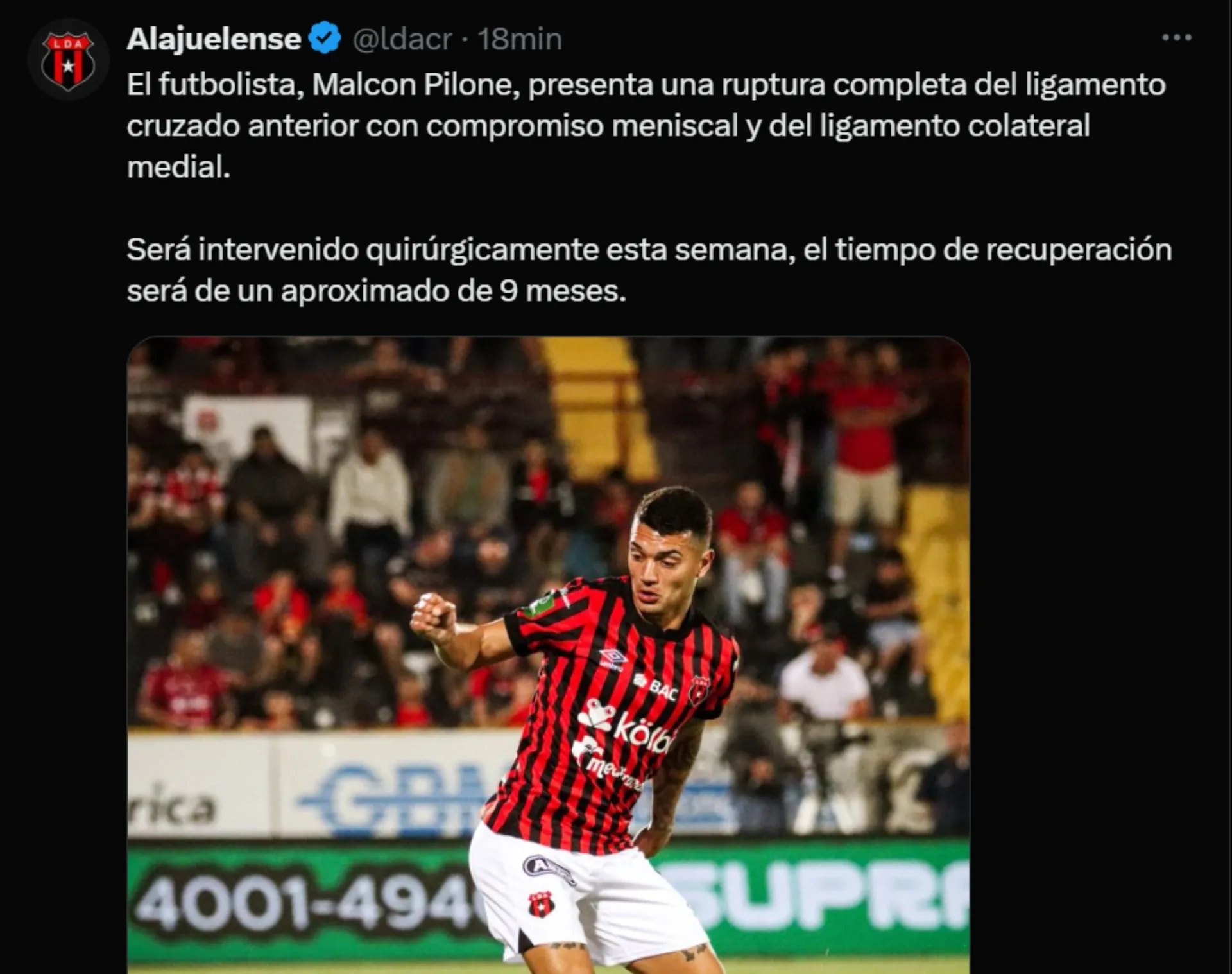 Alajuelense confirmó la lesión de Malcom Pilone. (Foto:X )