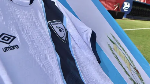 El chapín lucha por su vida.