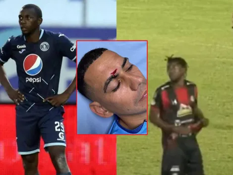 "Muma" Fernández rompe el silencio y responde a las acusaciones que recibe de amaño de partidos