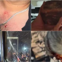 Lamentable: Aficionados de Xelajú agreden a jugadores de Guastatoya en la Liga Nacional de Guatemala