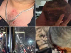 Lamentable: Aficionados de Xelajú agreden a jugadores de Guastatoya en la Liga Nacional de Guatemala