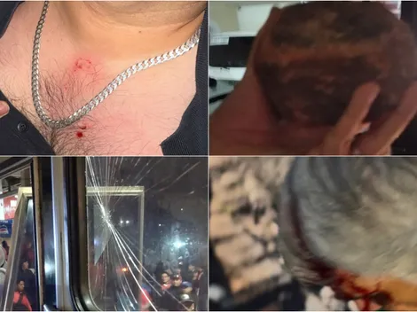 Lamentable: Aficionados de Xelajú agreden a jugadores de Guastatoya en la Liga Nacional de Guatemala